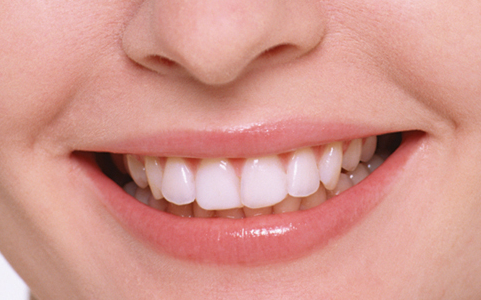 デュアルホワイトニング